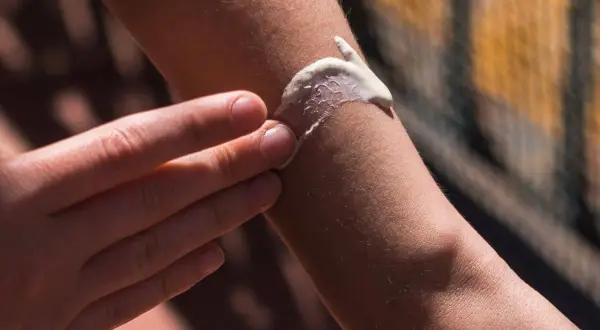 Eine Hand verteilt Sonnencreme auf einem Arm. Hilft Sonnencreme gegen Pickel? Die Haut wird geschützt.