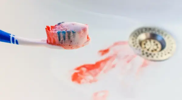 Szczoteczka do zębów z pianą i śladami krwi w umywalce. Krwawiące dziąsła to sygnał, by udać się do dentysty.