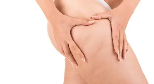 Jak zwalczyć cellulit na udach? Kompleksowy przewodnik i skuteczne metody