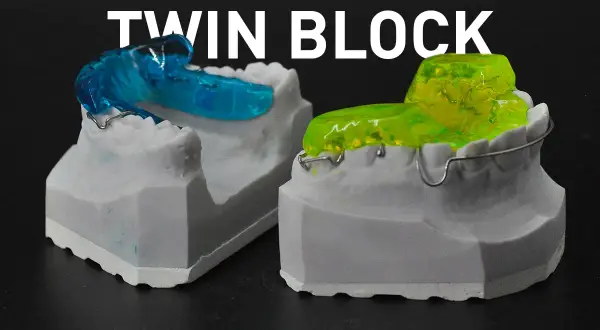 Modelli dentali con apparecchi **twin block ortodonzia** blu e gialli, pronti per correggere la malocclusione.