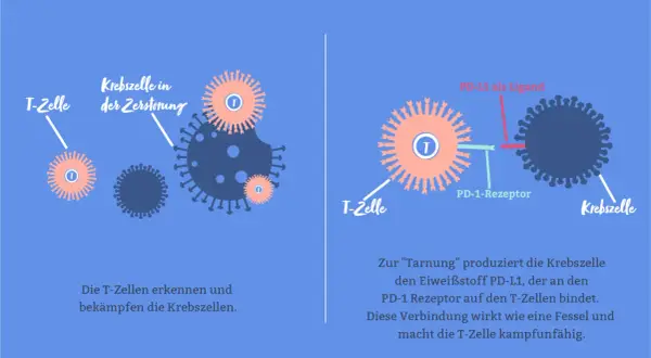 Immuntherapie bei Brustkrebs: T-Zellen bekämpfen Krebszellen, die sich durch PD-L1 tarnen.
