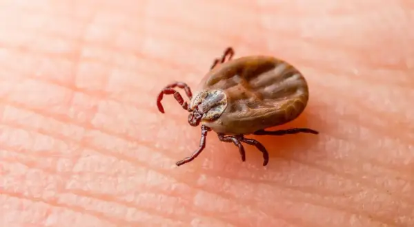 Kleszcz na skórze, potencjalne źródło choroby z Lyme.
