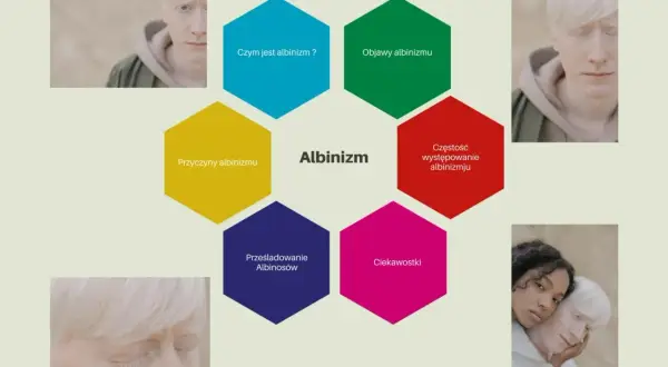 Grafika przedstawia schemat informacyjny o albinizmie, z portretami osób z albinizmem.