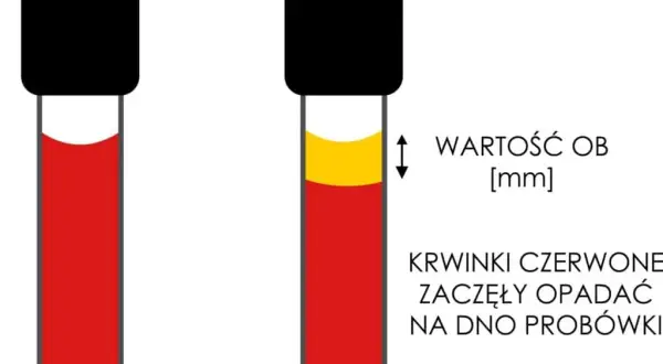 Skrzep w próbce krwi: Błąd czy choroba? Zrozum swój wynik
