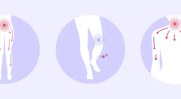 Schmerzhafte Ausstrahlung in Beine und Arme, Knie- und Nackenbeschwerden – typische spinalkanalstenose symptome.