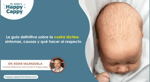 Bebé con costra láctea. Guía definitiva sobre síntomas, causas y tratamiento de la costra láctea. Dr. Eddie Valenzuela.