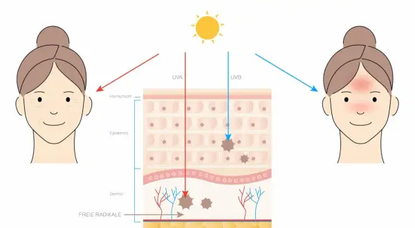 Illustration zeigt, wie UVA und UVB-Strahlen die Haut schädigen. Sonnencreme schützt vor diesen Strahlen.