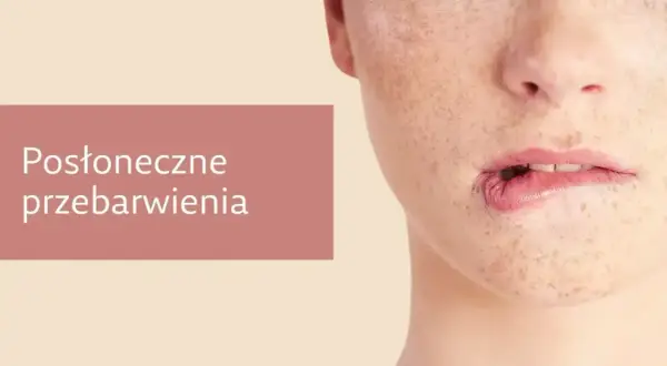 Zbliżenie na twarz z widocznymi przebarwieniami i piegami. Kobieta lekko przygryza dolną wargę.
