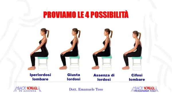 Quattro posture a confronto: iperlordosi lombare, lordosi corretta, assenza di lordosi e cifosi lombare. Utile per esercizi posturali.