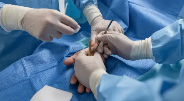Chirurg ręki: Jak wybrać najlepszą klinikę i specjalistę?