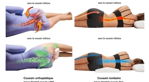 Comparaison de la posture du dos sans et avec coussin. Aide à soulager la douleur lombaire la nuit et le matin.