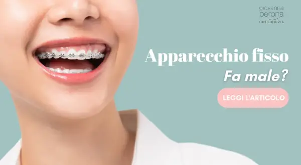 Sorriso con apparecchio fisso. Fa male togliere l'apparecchio fisso? Scopri di più leggendo l'articolo.