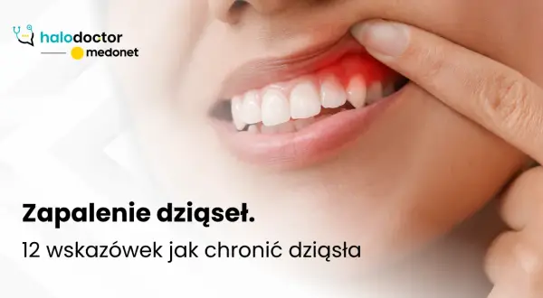 Zapalenie dziąseł: co robić, by uratować dziąsła i zęby? Poradnik.