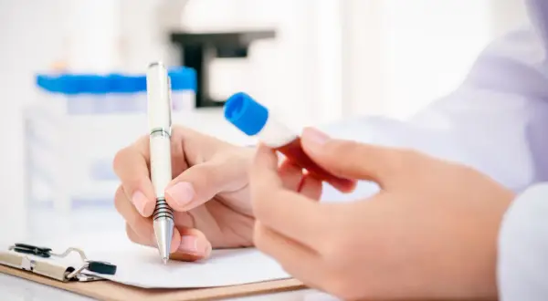 Badanie poziomu homocysteiny co to jest. Ręce naukowca z probówką krwi i długopisem nad notatkami w laboratorium.