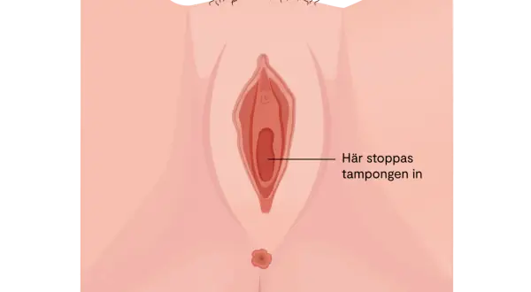Illustration av en kvinnas underliv. En pil pekar in i vaginan med texten "Här stoppas tampongen in". Kan vara relevant vid diskussion om svamp i underlivet gravid.