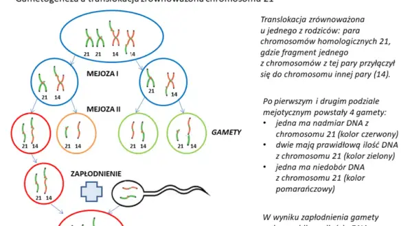 Zespół Downa: objawy, diagnoza i życie z trisomią 21