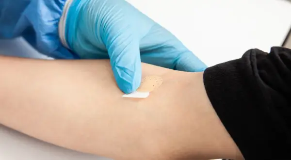 Ręka w niebieskiej rękawiczce zakłada plaster na ramię. Może to być związane z badaniem poziomu kortyzolu i jego objawami.