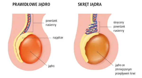 Urolog czy androlog? Kto leczy jądra i kiedy iść do lekarza?