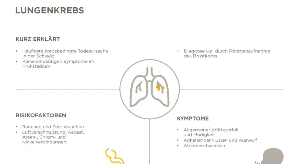 Grafik erklärt Lungenkrebs: Risikofaktoren wie Rauchen, Symptome wie Husten und die Diagnose eines Lungen tumor.
