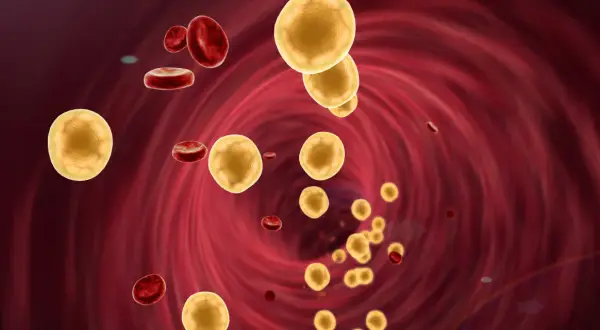 Jak obniżyć cholesterol na diecie keto? Skuteczne strategie i porady