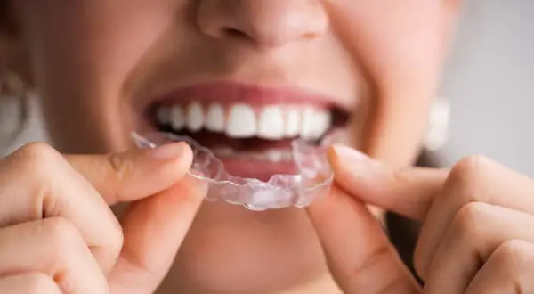 Dettaglio di una persona che tiene una mascherina trasparente, mostrando la differenza tra bite e mascherina per l'allineamento dentale.