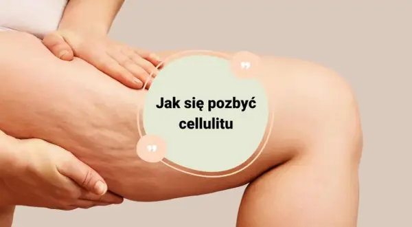Zbliżenie na udo z widocznym cellulitem, tekst "Jak się pozbyć cellulitu".