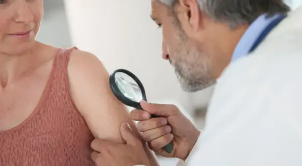 Dermatolog bada pieprzyk u pacjentki. Czy do dermatologa na NFZ potrzebne jest skierowanie? Sprawdź!