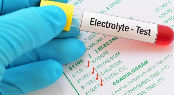 Rękawiczka w niebieskiej rękawiczce trzyma probówkę z napisem "Electrolyte - Test". Obok widać formularz z badaniami, w tym "COAGULOGRAM".