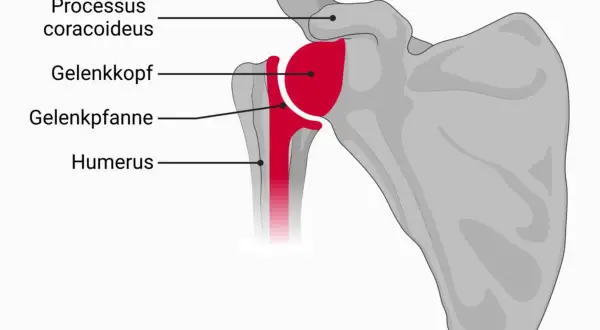 Anatomische Darstellung des Schultergelenks mit Humerus, Gelenkkopf, Gelenkpfanne, Acromion und Processus coracoideus. Eine inverse Schulterprothese ersetzt diese Strukturen.