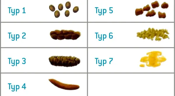 Classificazione delle scorie alimentari: da grumi separati a feci liquide, ogni tipo indica qualcosa.