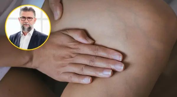 Wysoki cholesterol: Czym grozi? Cichy zabójca serca i zdrowia