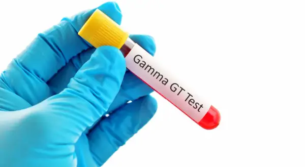 Rękawiczka z niebieskiej lateksu trzyma probówkę z krwią do badania Gamma GT. To badanie ocenia funkcję wątroby.