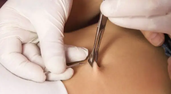 En piercare med vita handskar använder en klämma och nål för att utföra en achilles piercing.