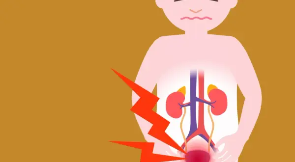 Personne souffrant de douleurs à la vessie hyperactive, avec des éclairs rouges symbolisant la douleur. Avis sur Urostim 2.