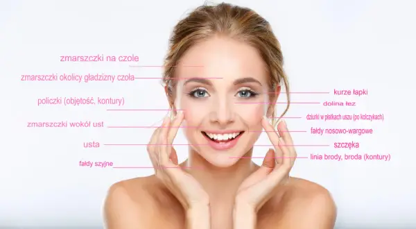 Uśmiechnięta kobieta z zaznaczonymi obszarami twarzy, gdzie można zastosować botox lub kwas hialuronowy na zmarszczki palacza i inne niedoskonałości.