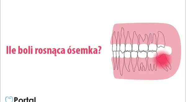 Ósemki: Kiedy rosną? Objawy, ból i kiedy iść do dentysty