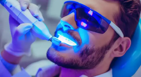 Mężczyzna w okularach ochronnych przechodzi wybielanie zębów u dentysty. Niebieskie światło lampy aktywuje żel wybielający.