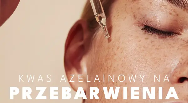 Kwas azelainowy na przebarwienia. Kropla serum z kwasem azelainowym na skórze z piegami.