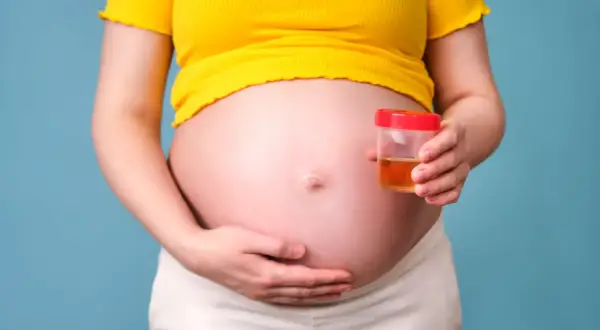 Ciężarna kobieta trzyma pojemnik z próbką moczu, badanie na obecność ketonów w moczu w ciąży.