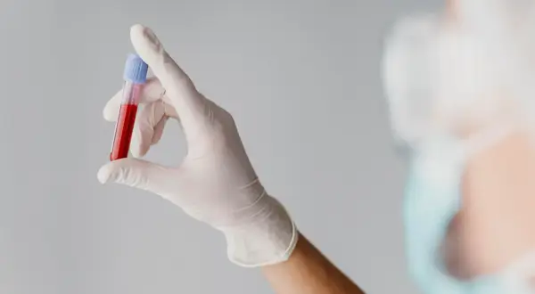 Ręka w białej rękawiczce trzyma probówkę z krwią do badań, np. mchc.