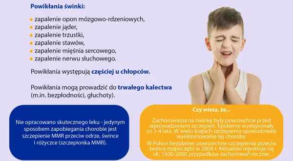 Chłopiec z bólem gardła, objaw świnki. Choroba wirusowa, groźna powikłaniami, np. głuchotą. Szczepienie MMR chroni przed świnką.