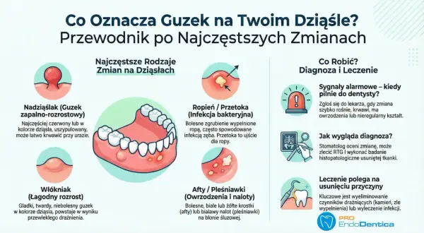 Bezbolesny guzek na dziąśle może być włókniakiem, łagodnym rozrostem. Ilustracja pokazuje różne zmiany na dziąsłach.