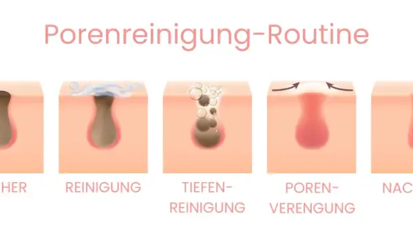 Schritt-für-Schritt-Anleitung zur Porenreinigung: Entfernen von tiefsitzenden Mitessern durch Reinigung und Verengung der Poren für reine Haut.