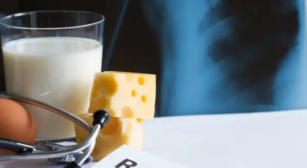 Szklanka mleka, ser, jajko i stetoskop na tle zdjęcia rentgenowskiego. Zdrowa dieta bogata w wapń jest kluczowa dla mocnych kości.