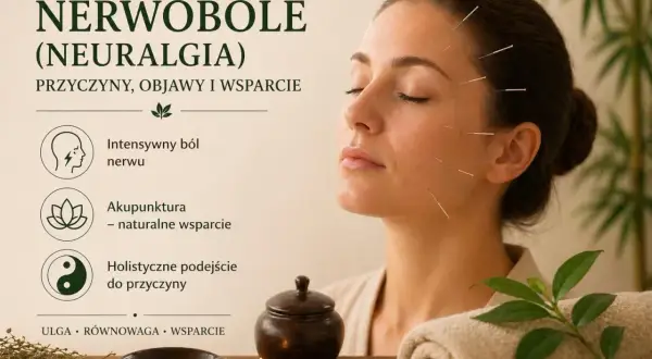 Akupunktura jako naturalne wsparcie w leczeniu nerwu trójdzielnego. Ulga, równowaga i holistyczne podejście do przyczyny neuralgii.