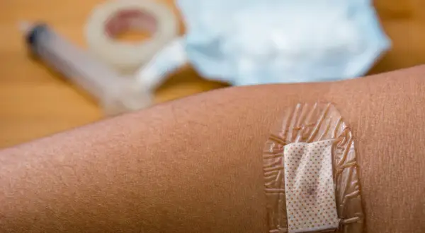 Plaster na skórze, pod nim widoczna drobna ziarnina. W tle strzykawka i taśma medyczna.