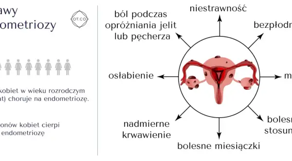 Objawy endometriozy: ból, niestrawność, bezpłodność, mdłości, bolesny stosunek, bolesne miesiączki, nadmierne krwawienie, osłabienie. 1 na 10 kobiet choruje.