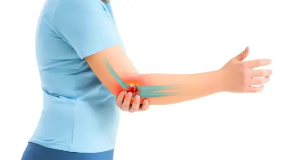 Une personne souffre d'une tendinite au coude, indiquée par une zone rouge. La glace peut aider à soulager la douleur.