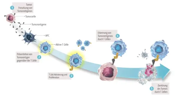 Schema der Immuntherapie: T-Zellen erkennen und zerstören Tumorzellen. Medikamenten-Namen sind hier nicht aufgeführt, aber der Prozess wird erklärt.