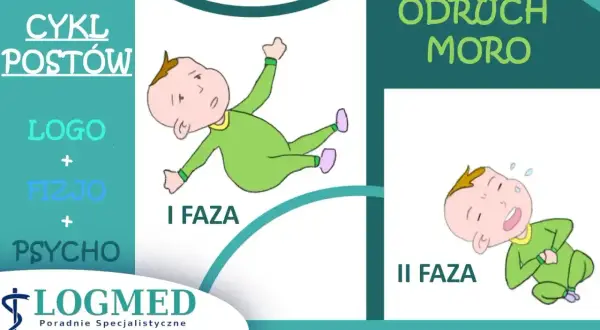 Ilustracja pokazuje dwie fazy odruchu Moro u niemowląt: I faza - dziecko wyciąga ręce i nogi, II faza - dziecko przyciąga kończyny do ciała.